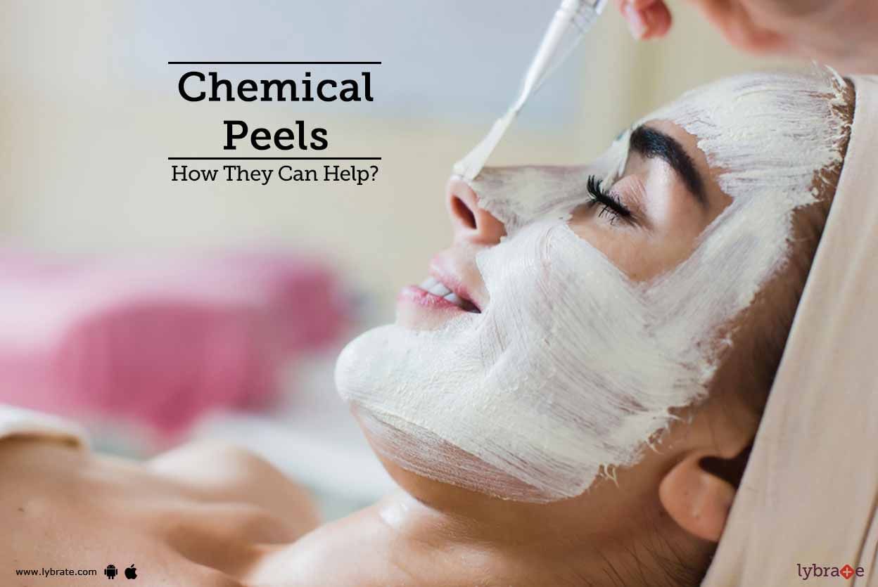 Chemical Peels - How They Can Help?