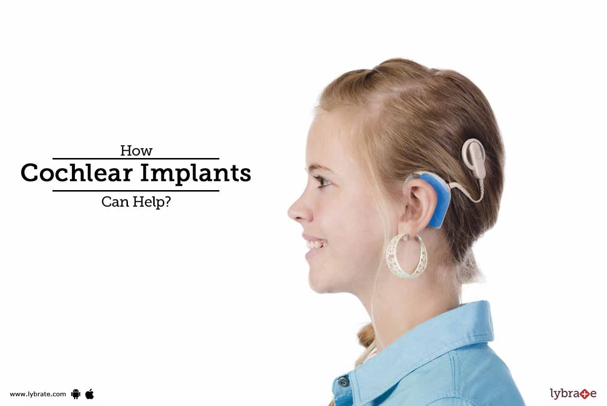 How Cochlear Implants Can Help?