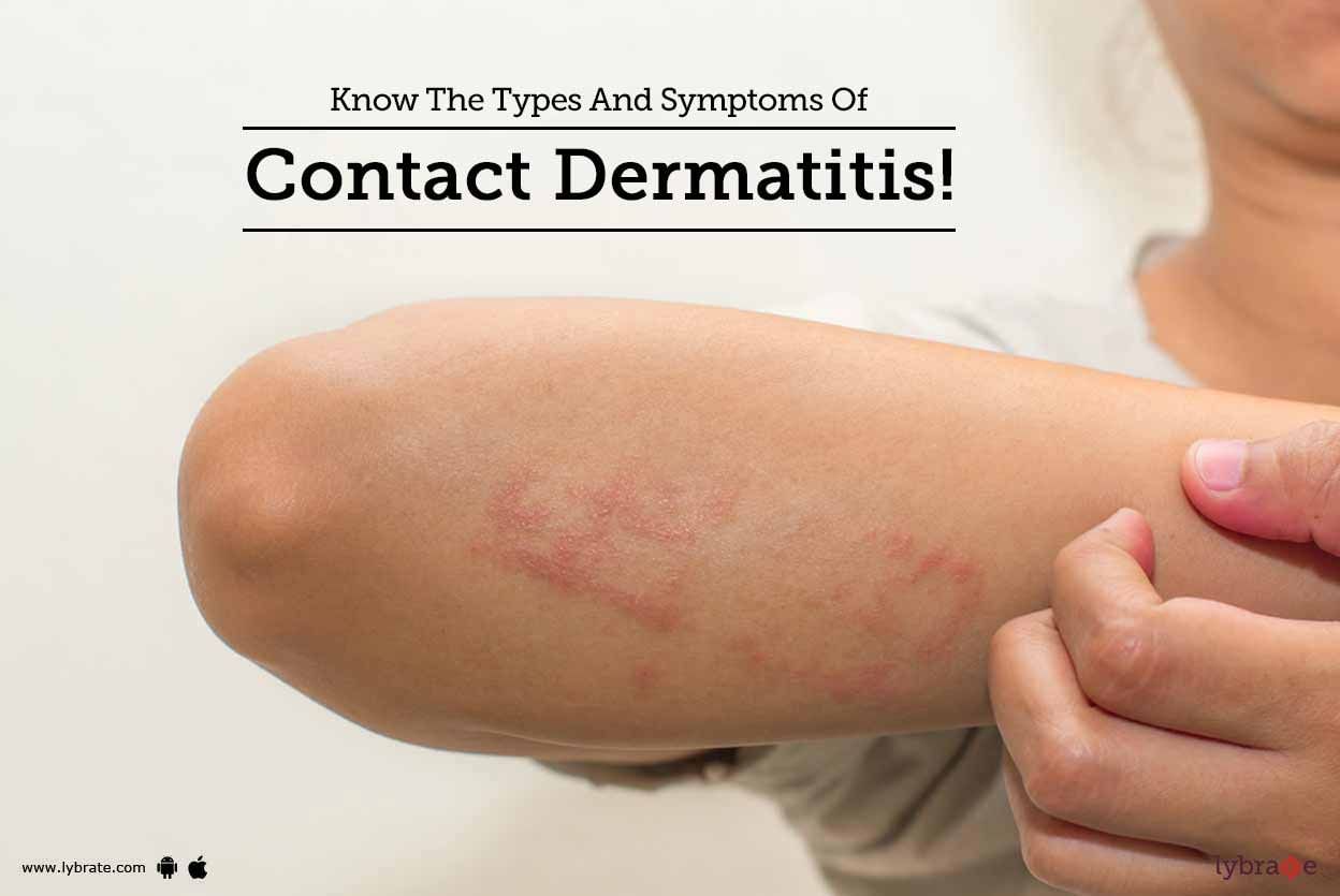 Know The Types And Symptoms Of Contact Dermatitis!