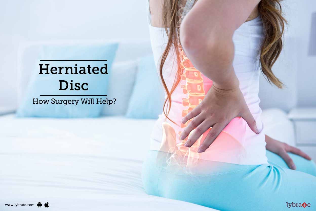 Herniated Disc - How Surgery Will Help?