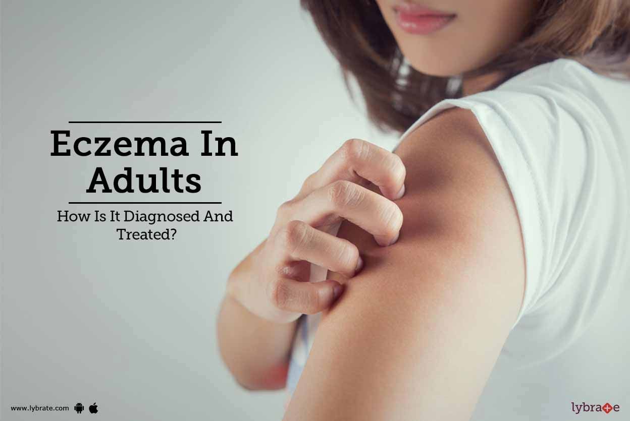 Eczema In Adults - How Is It Diagnosed And Treated?