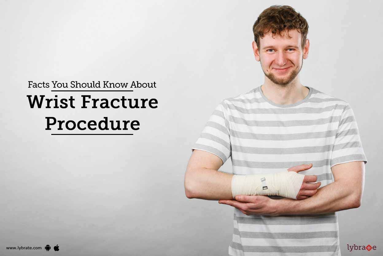 Facts You Should Know About Wrist Fracture Procedure