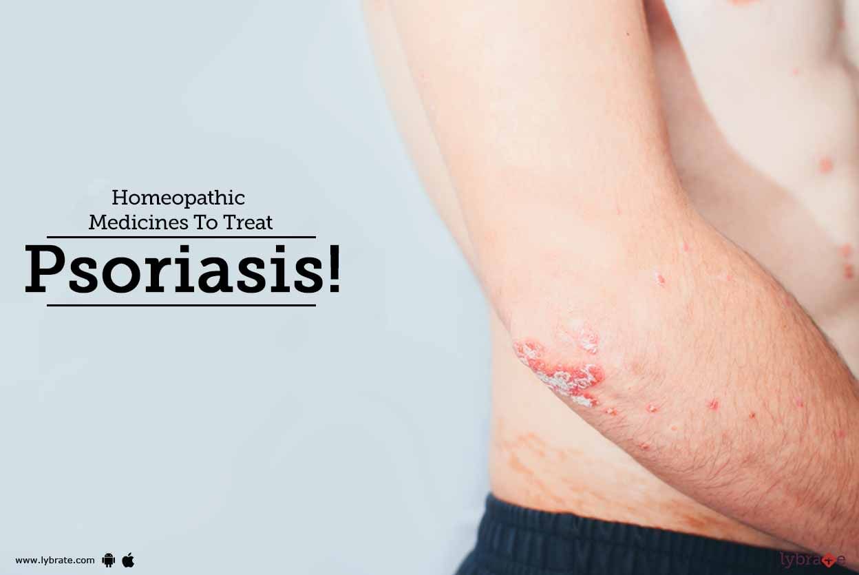 Homeopathic Medicines To Treat Psoriasis!