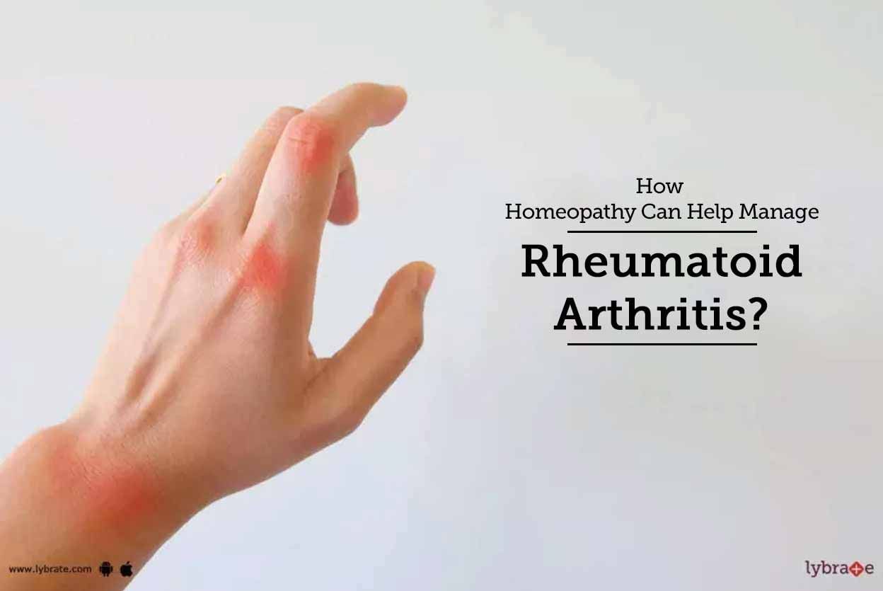 How Homeopathy Can Help Manage Rheumatoid Arthritis?