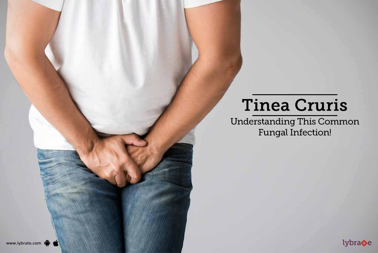 Tinea Cruris - Understanding This Common Fungal Infection!