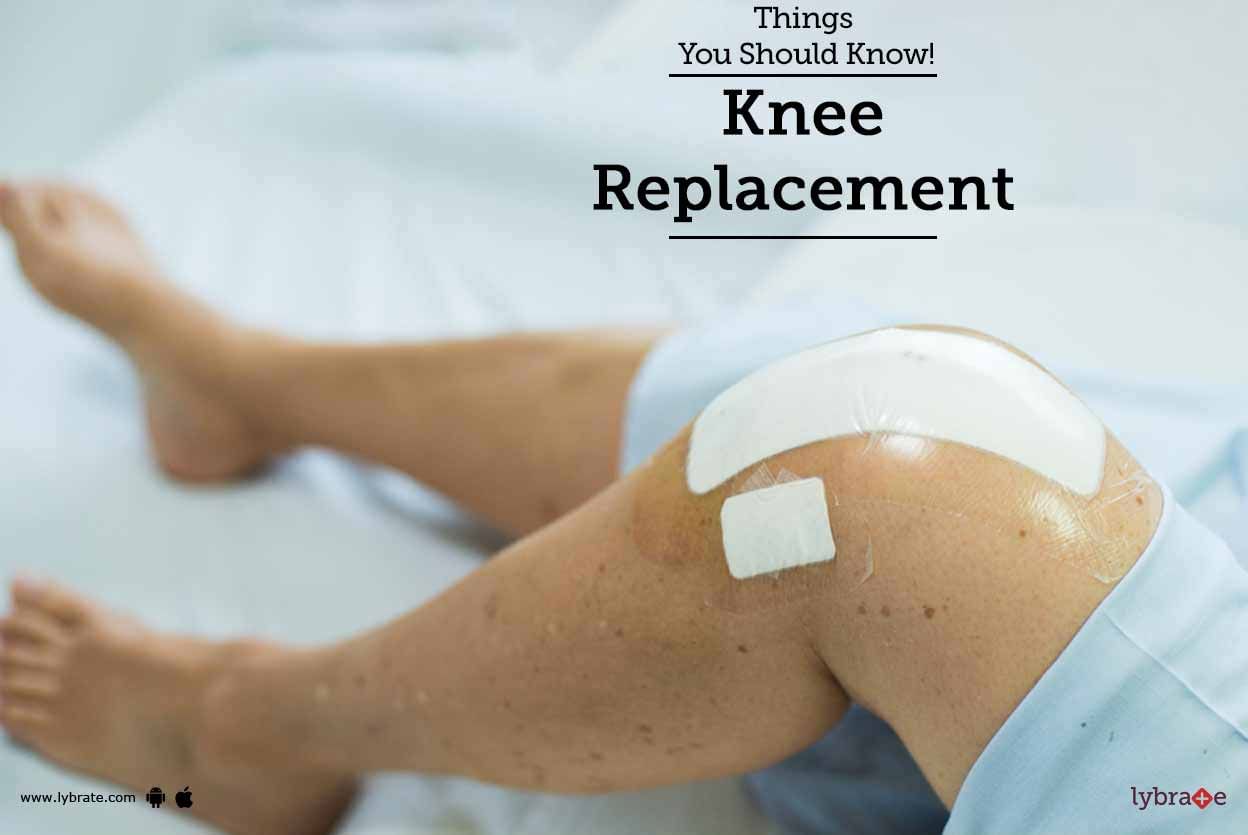 Knee Replacement - Things You Should Know!