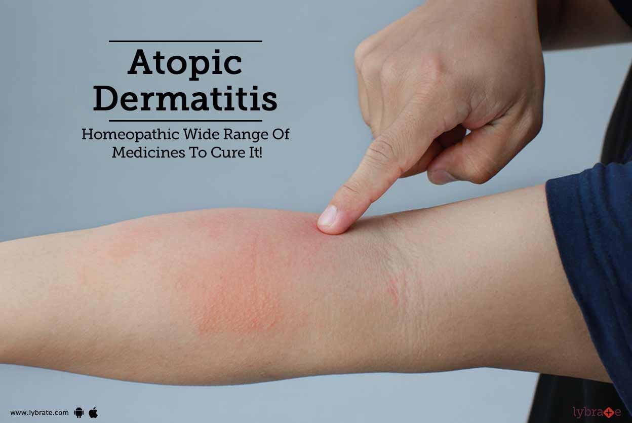 Atopic Dermatitis - Homeopathic Wide Range Of Medicines To Cure It!