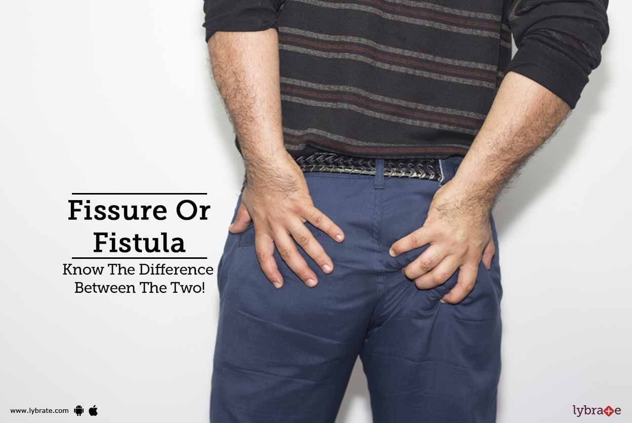 Fissure Or Fistula - Know The Difference Between The Two!