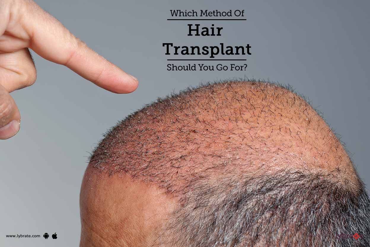Which Method Of Hair Transplant Should You Go For?