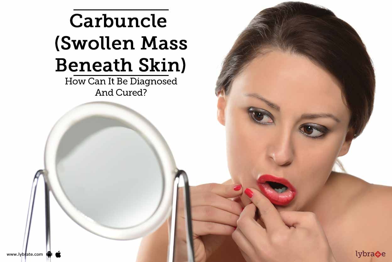 Carbuncle (Swollen Mass Beneath Skin) - How Can It Be Diagnosed And Cured?