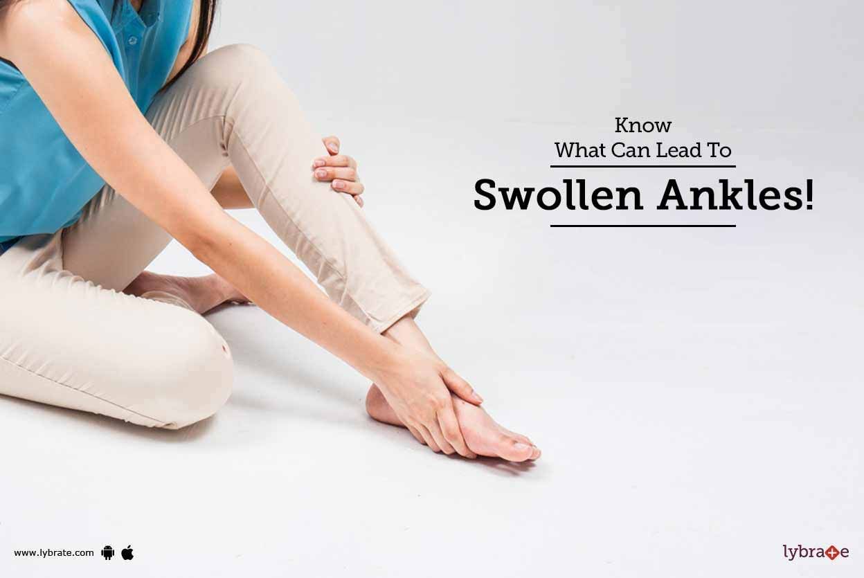 Know What Can Lead To Swollen Ankles!