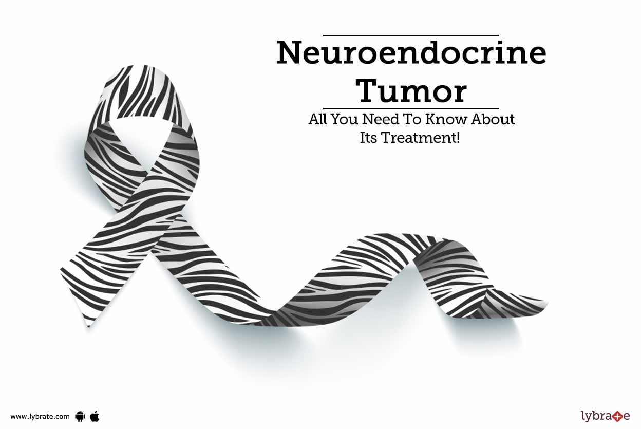 Neuroendocrine Tumor - All You Need To Know About Its Treatment!