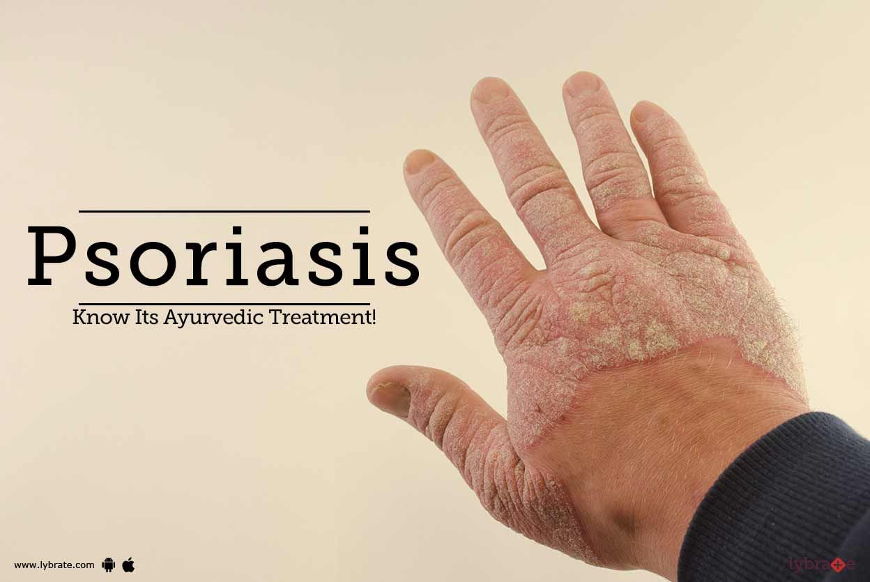 Psoriasis - Know Its Ayurvedic Treatment!