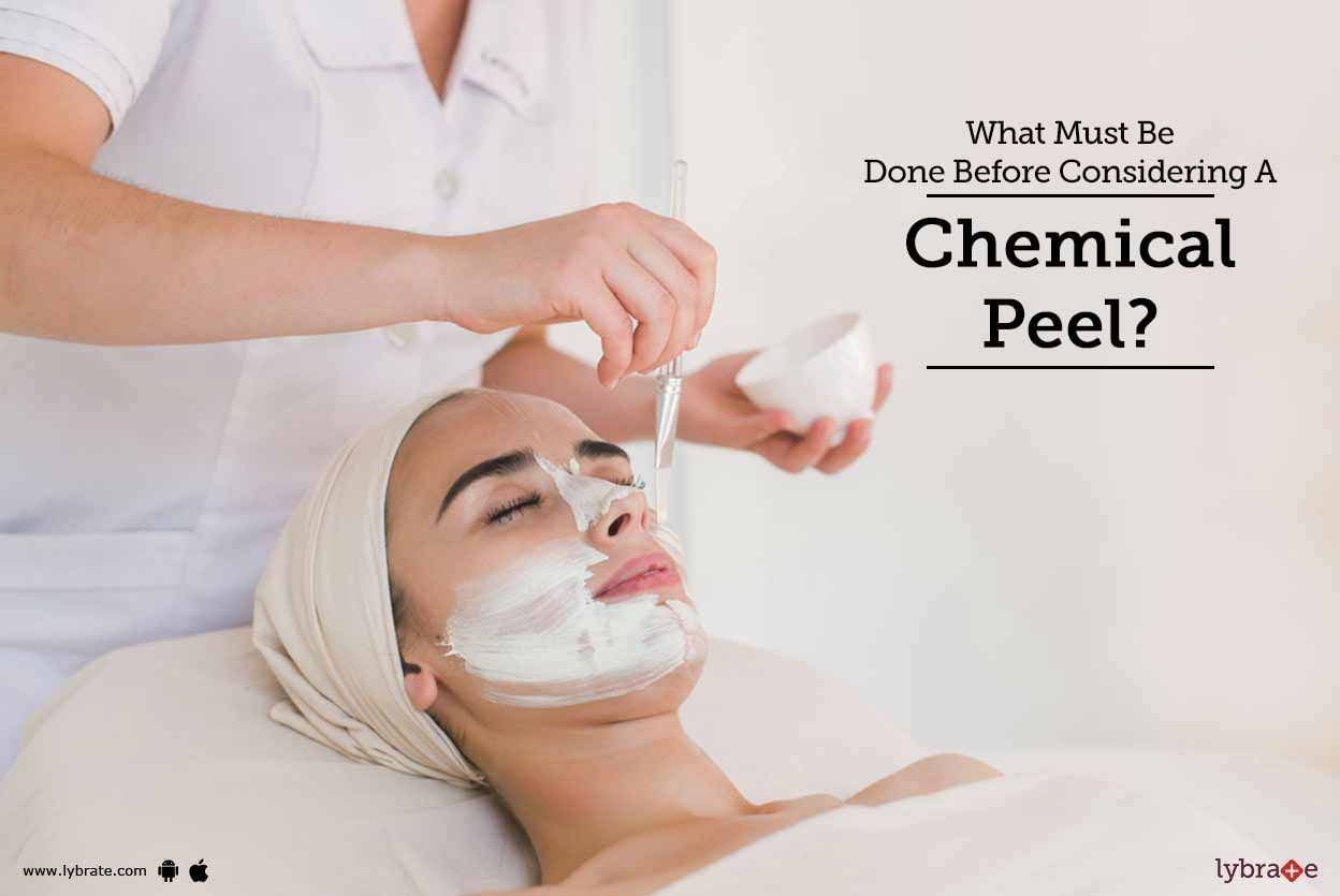 What Must Be Done Before Considering A Chemical Peel?
