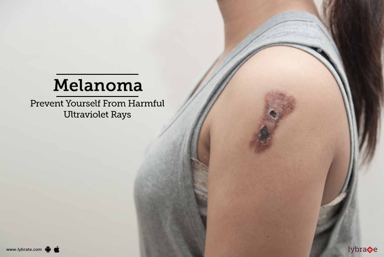 Melanoma: Prevent Yourself From Harmful Ultraviolet Rays