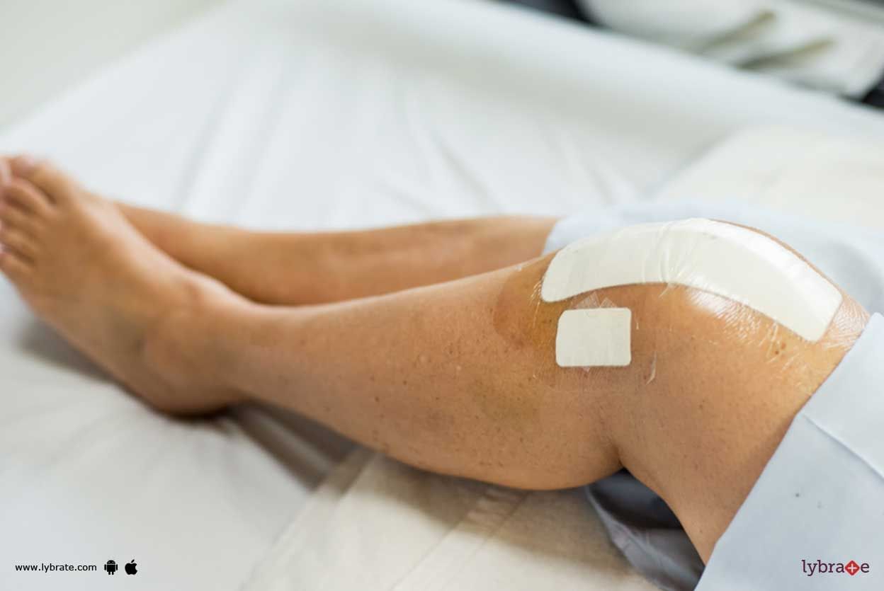 85% Knee And Slip Disc Surgeries Can Be Prevented - Know How!