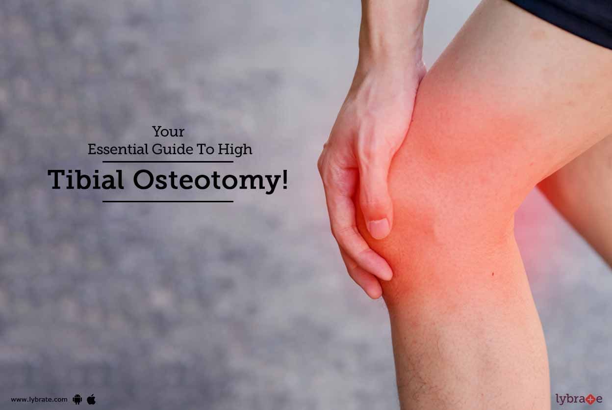 Your Essential Guide To High Tibial Osteotomy!