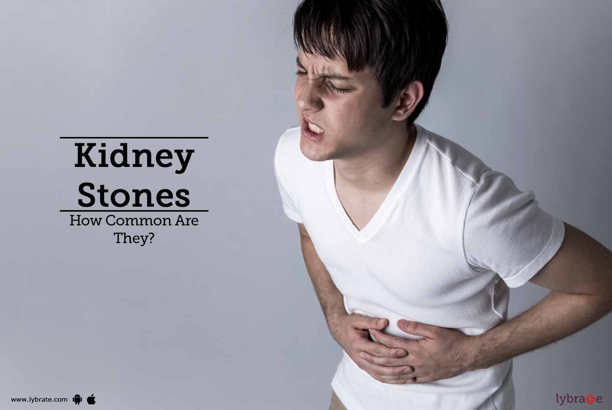 Kidney Stones - How Common Are They?