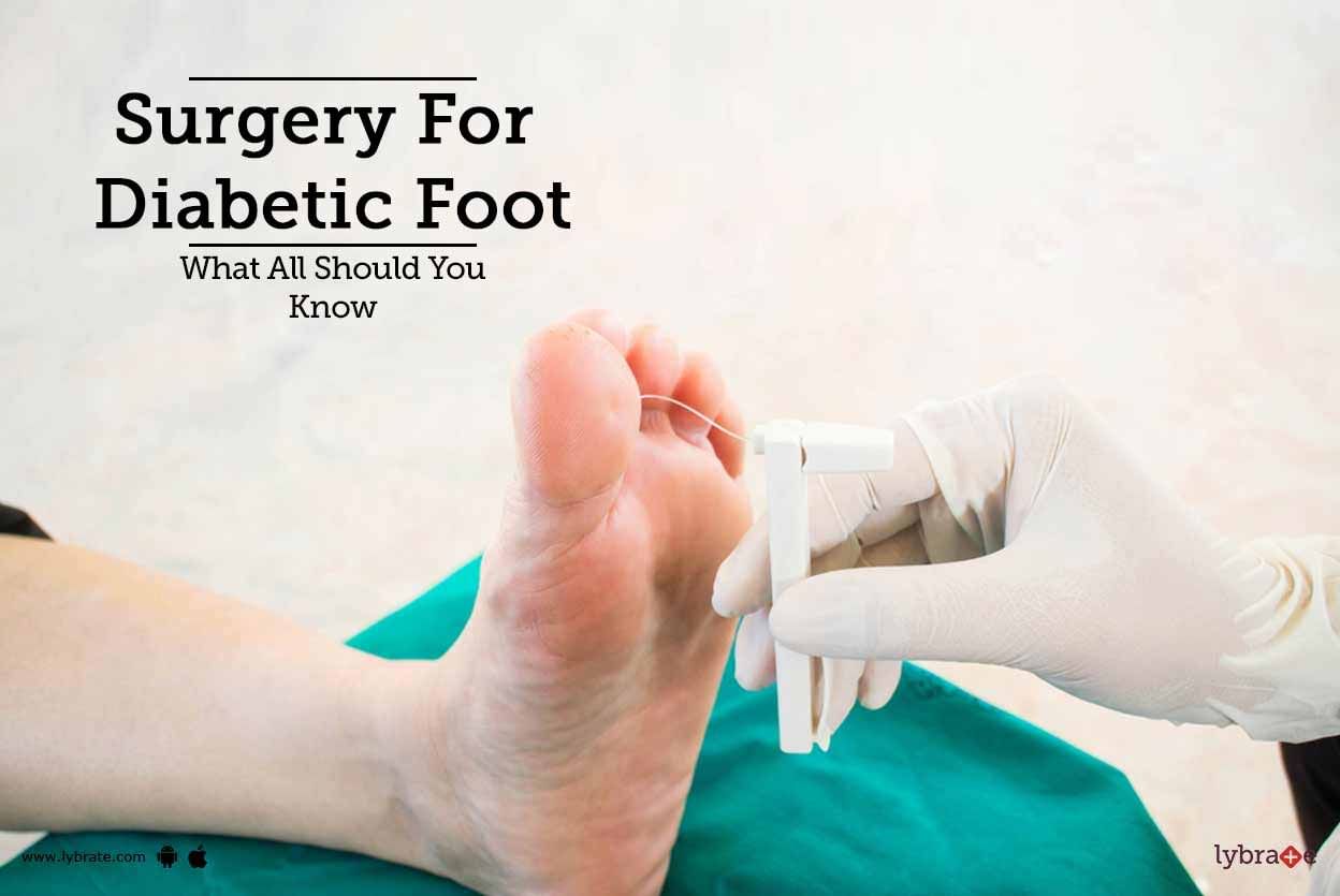 Surgery For Diabetic Foot - What All Should You Know
