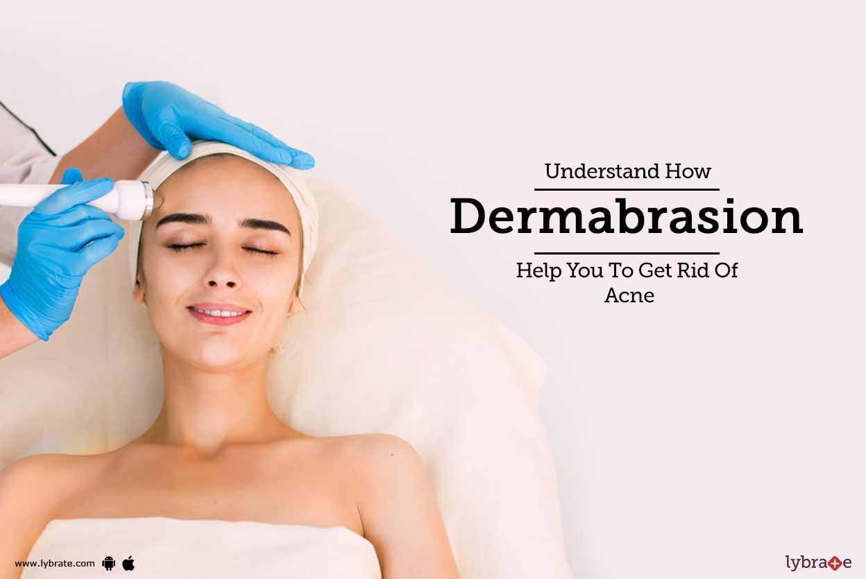 Understand How Dermabrasion Help You To Get Rid Of Acne