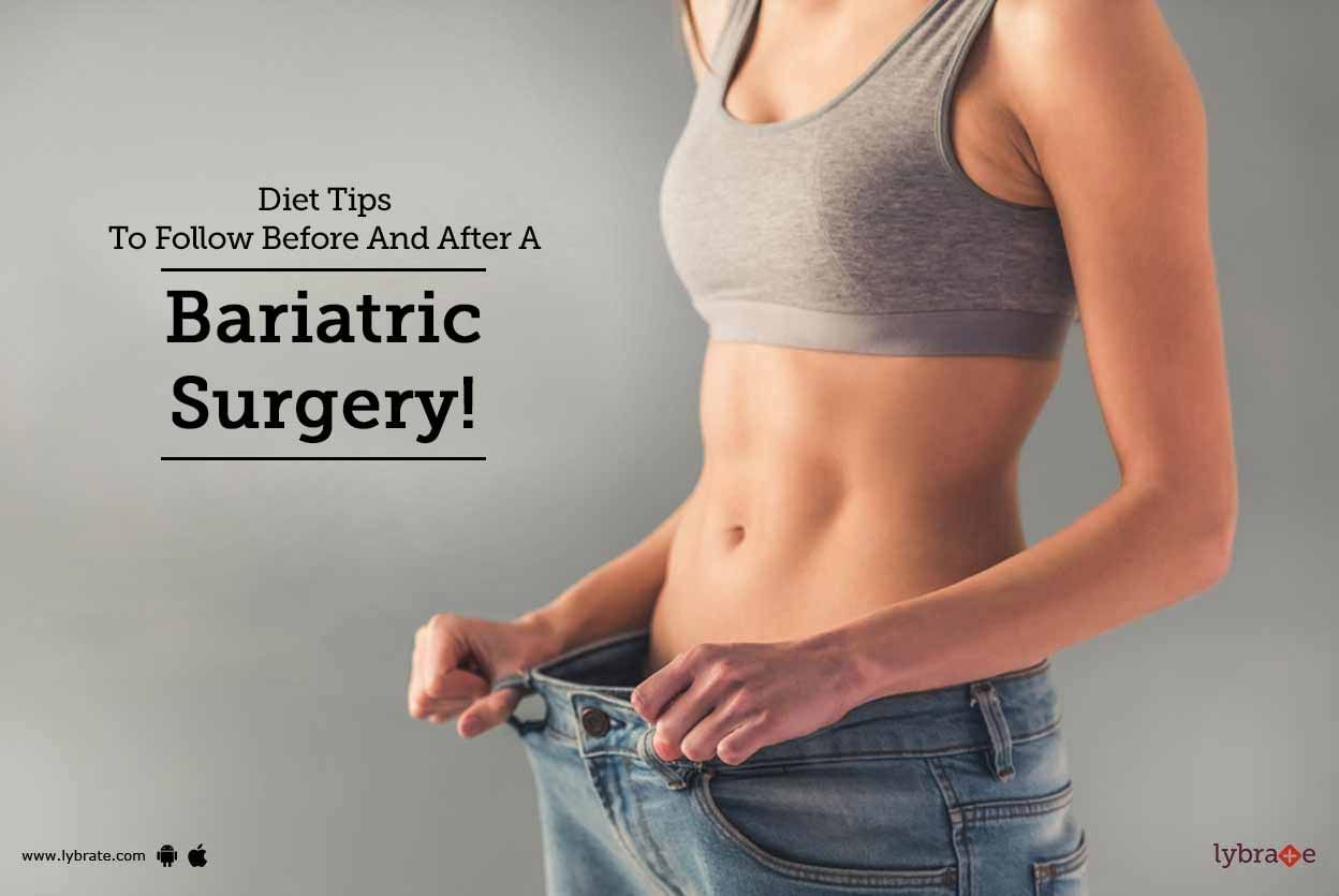 Diet Tips To Follow Before And After A Bariatric Surgery!