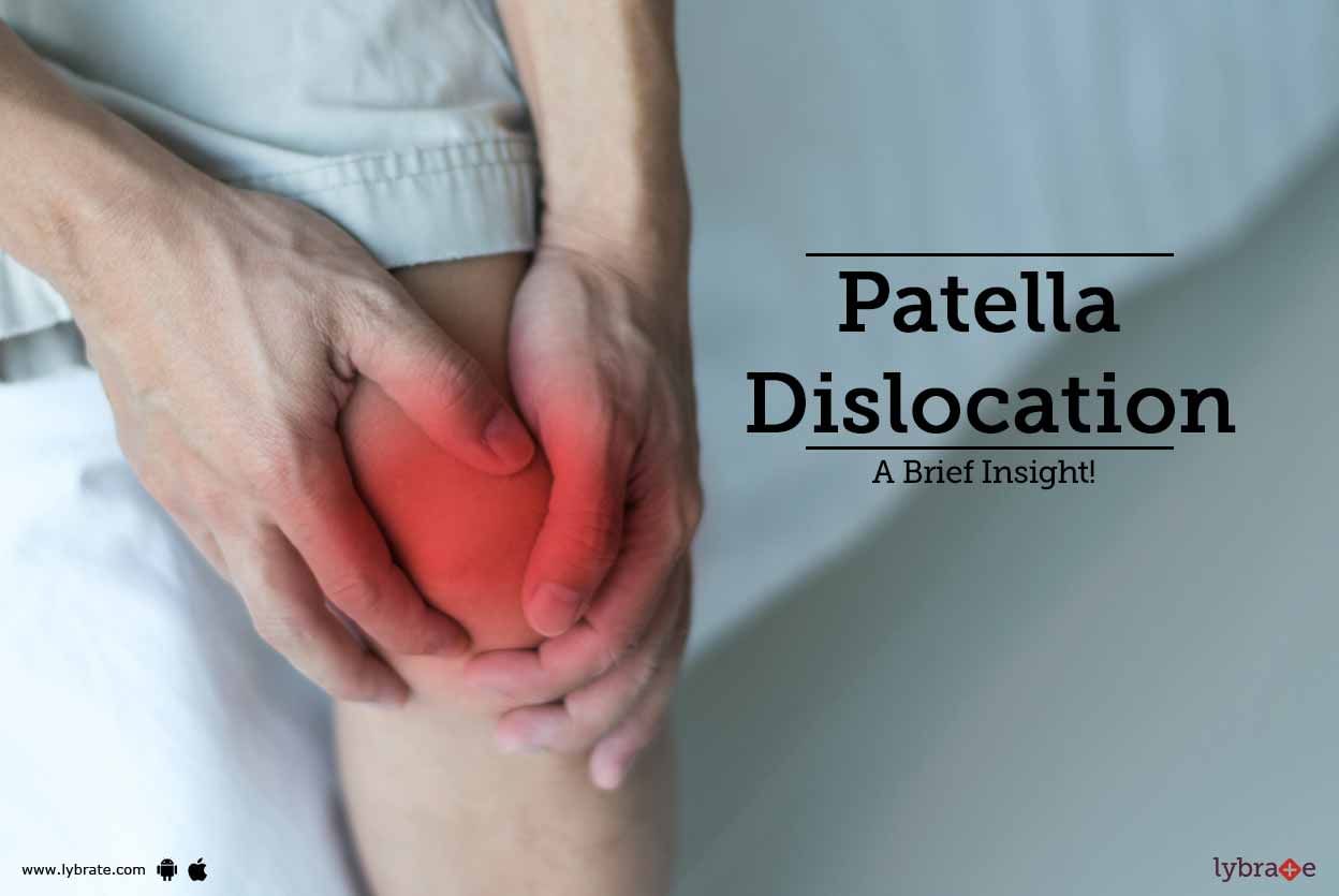Patella Dislocation - A Brief Insight!