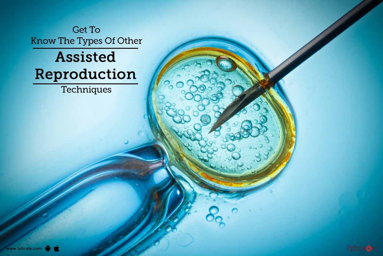 Get To Know The Types Of Other Assisted Reproduction Techniques