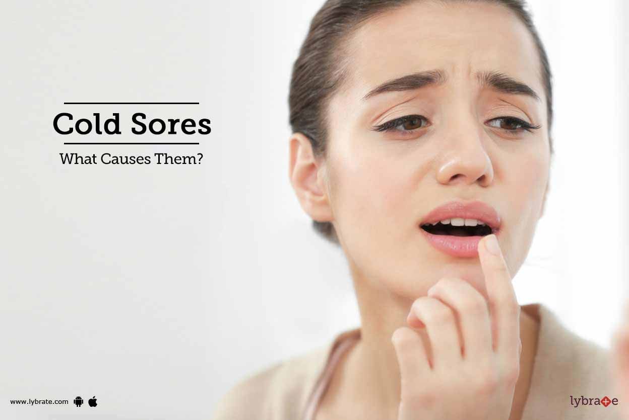 Cold Sores - What Causes Them?