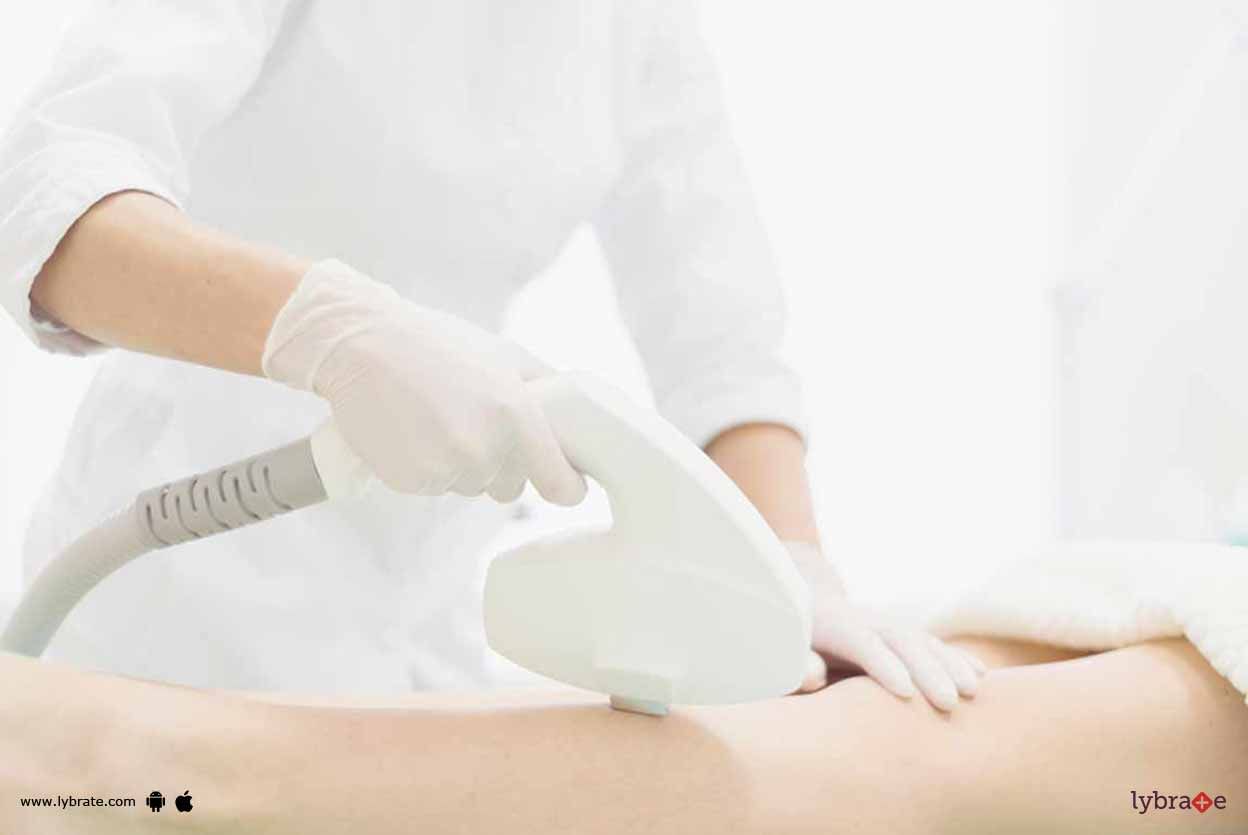 Know The Benefits Of Laser Hair Removal!