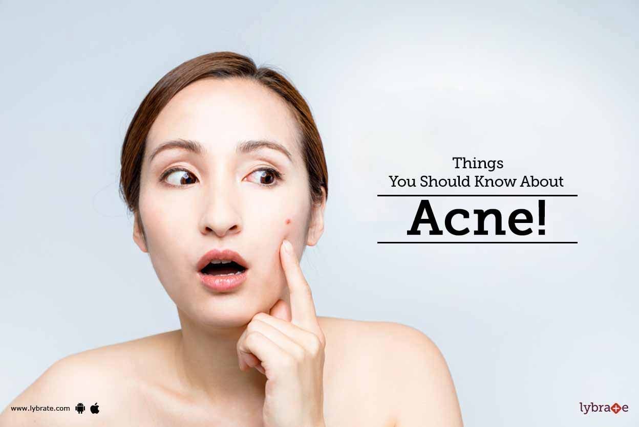 Things You Should Know About Acne!