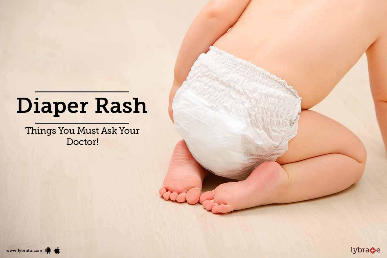 Diaper Rash - Things You Must Ask Your Doctor!