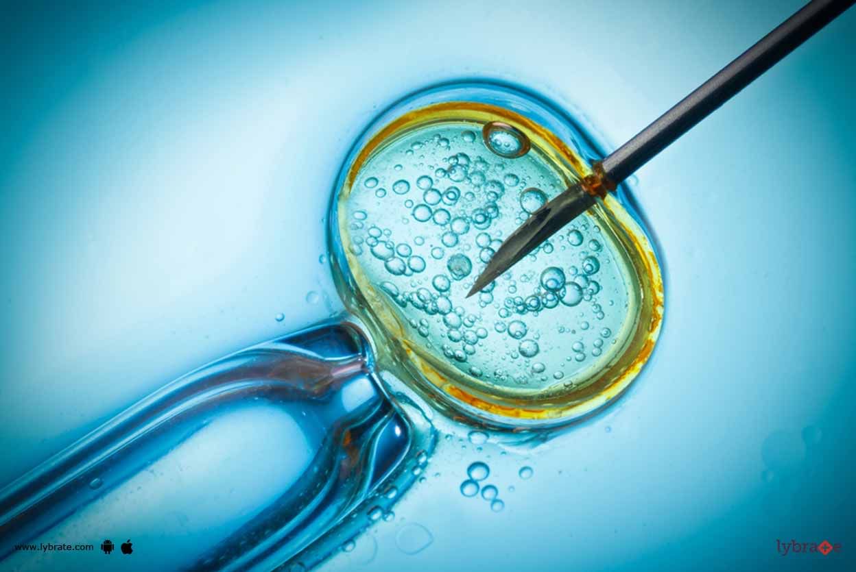 IVF Treatment - 5 Important Factors To Improve The Result!