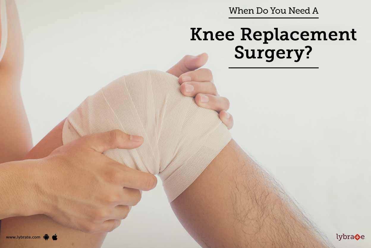 When Do You Need A Knee Replacement Surgery?