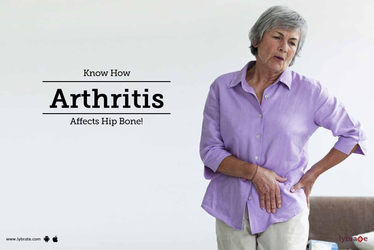 Know How Arthritis Affects Hip Bone!