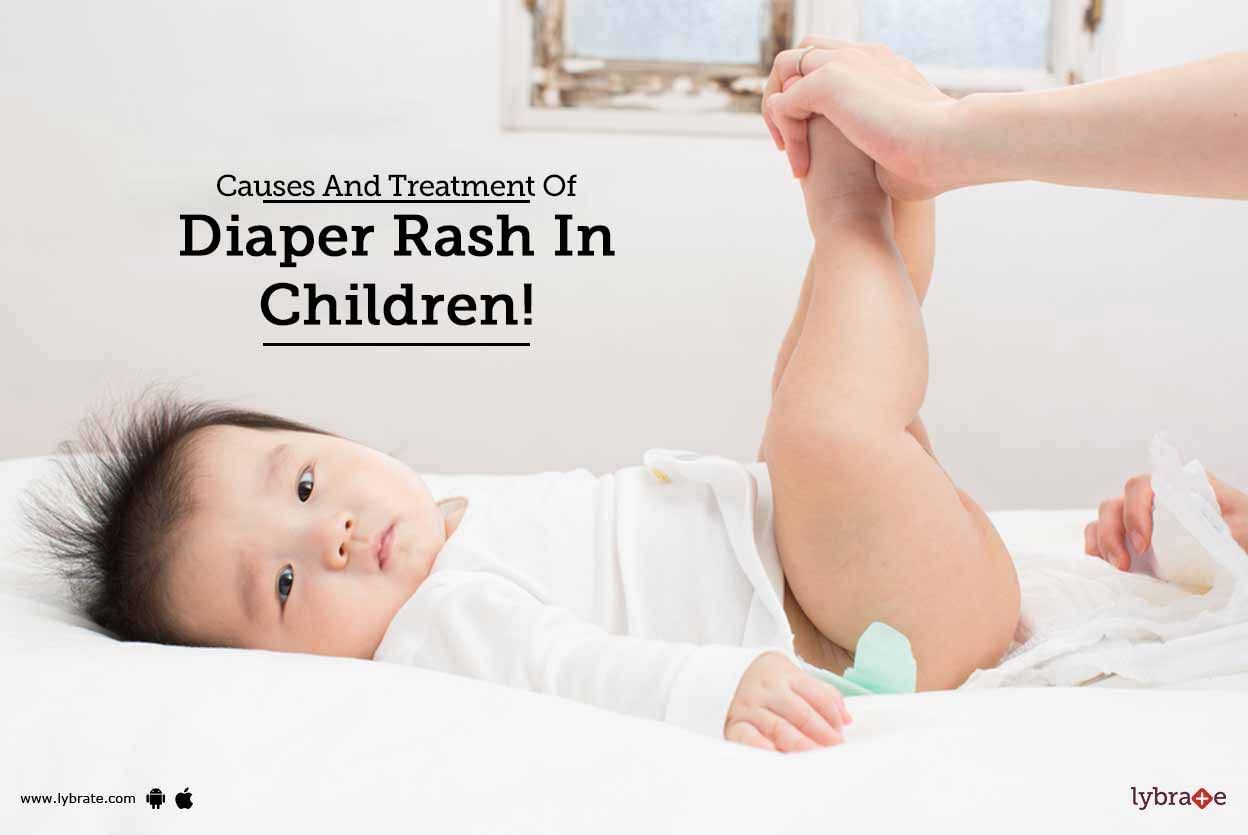 Causes And Treatment Of Diaper Rash In Children!