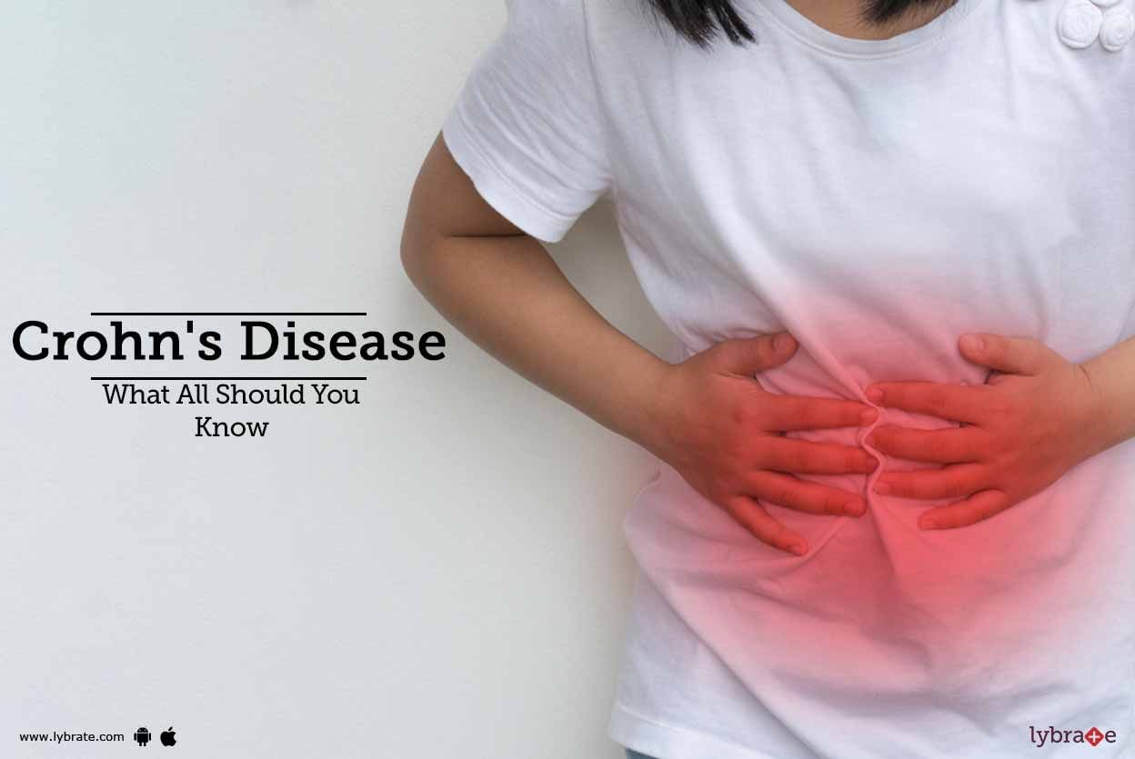 Crohn's Disease - What All Should You Know