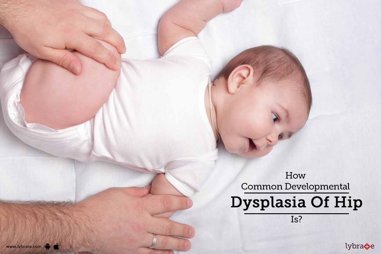 How Common Developmental Dysplasia Of Hip Is Treated?