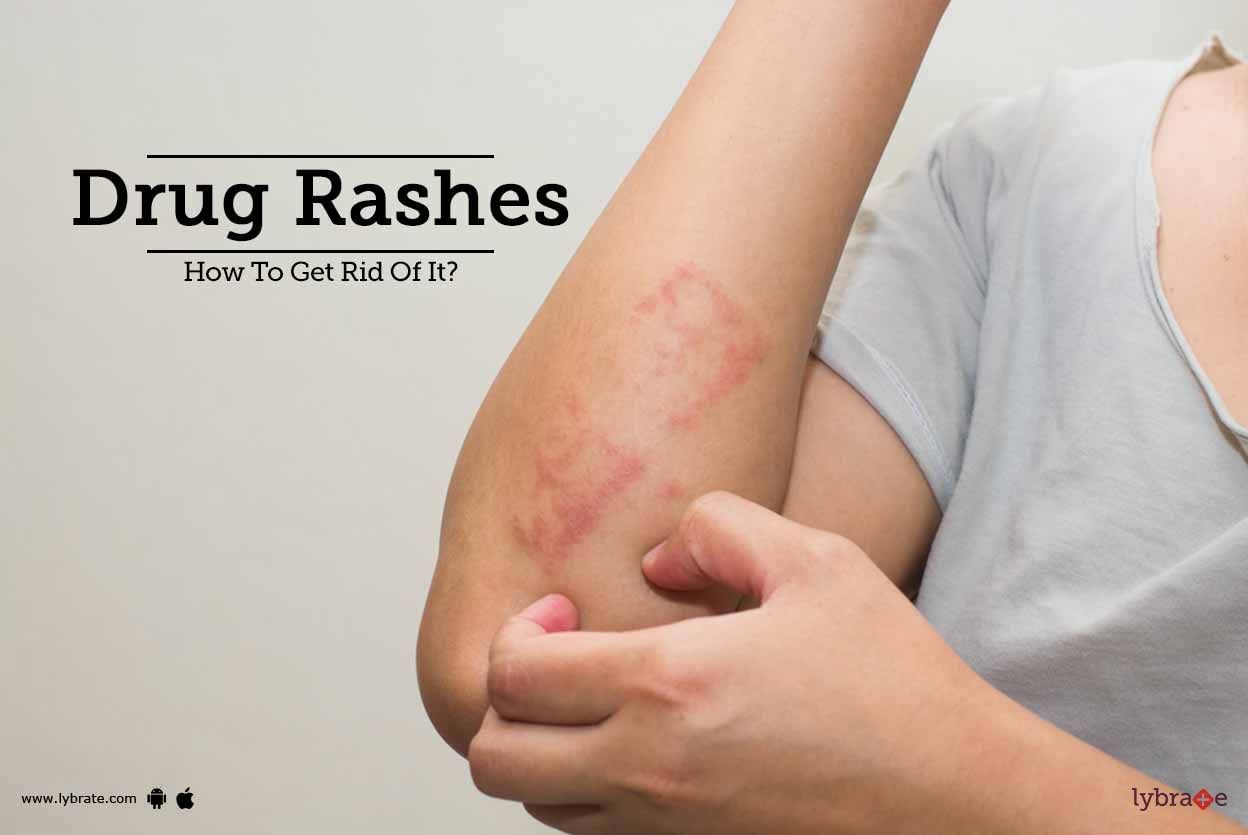 Drug Rashes - How To Get Rid Of Them?
