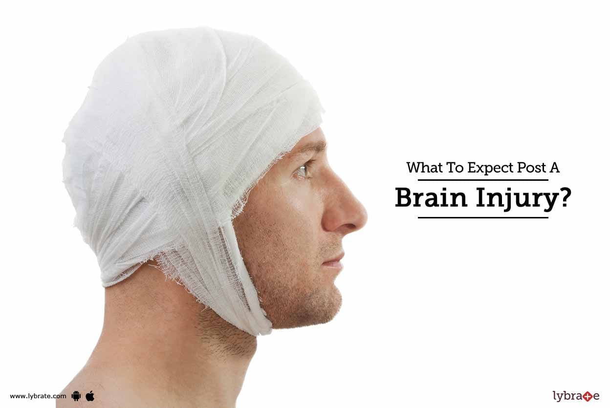 What To Expect Post A Brain Injury?