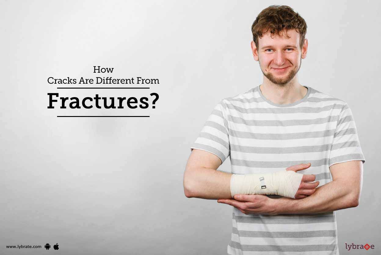 How Cracks Are Different From Fractures?