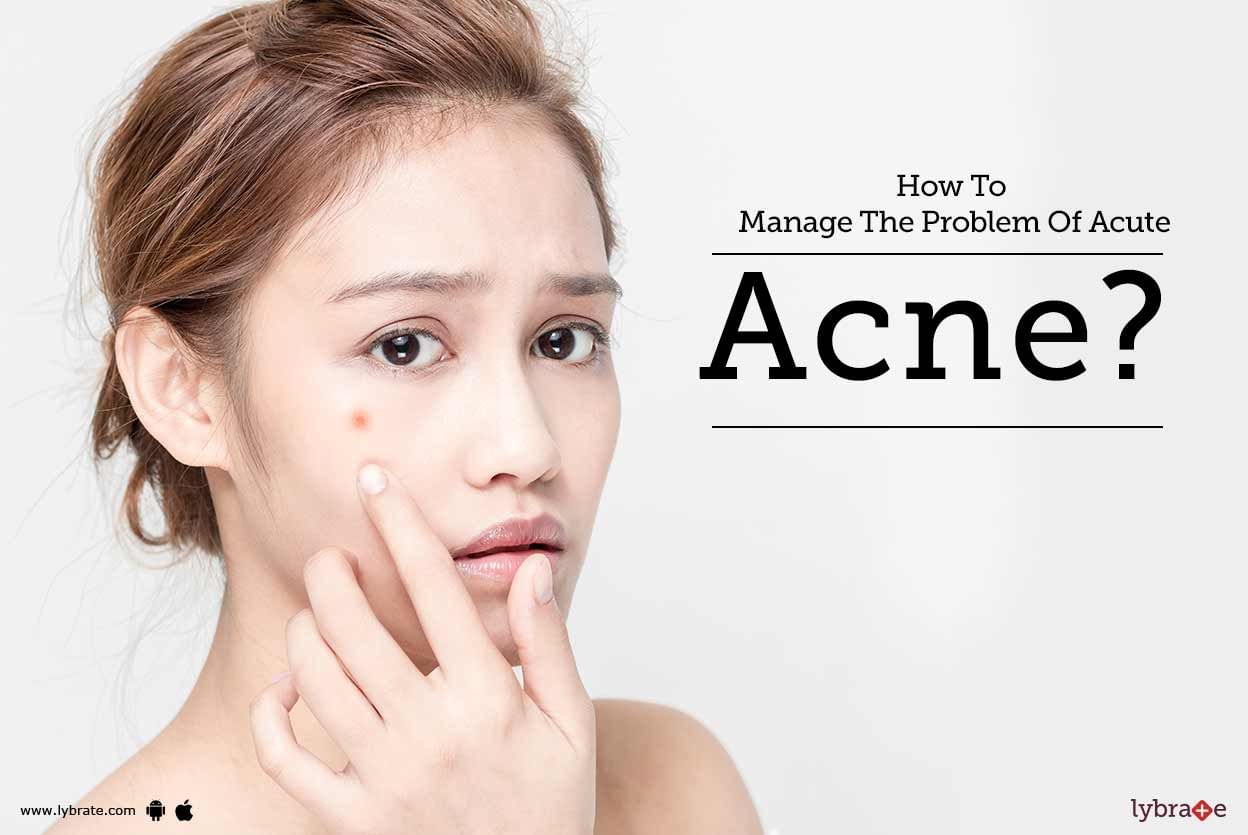 How To Manage The Problem Of Acute Acne?
