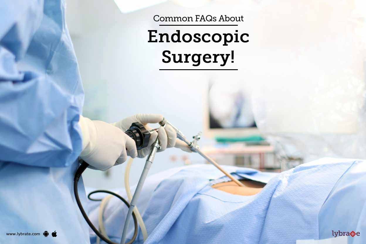 Common FAQs About Endoscopic Surgery!