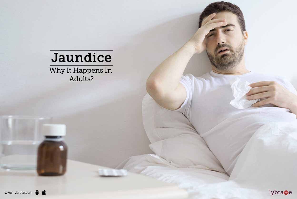 Jaundice: Why It Happens In Adults?