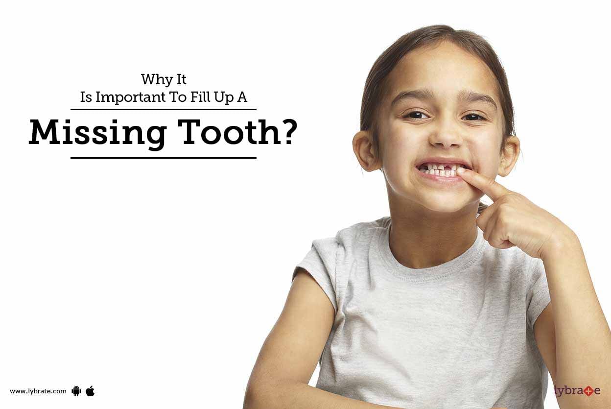 Why It Is Important To Fill Up A Missing Tooth?