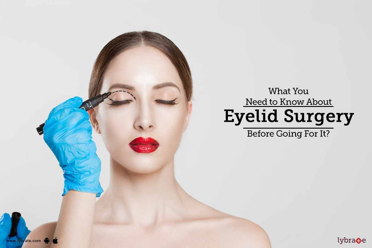 What You Need to Know About Eyelid Surgery Before Going For It?
