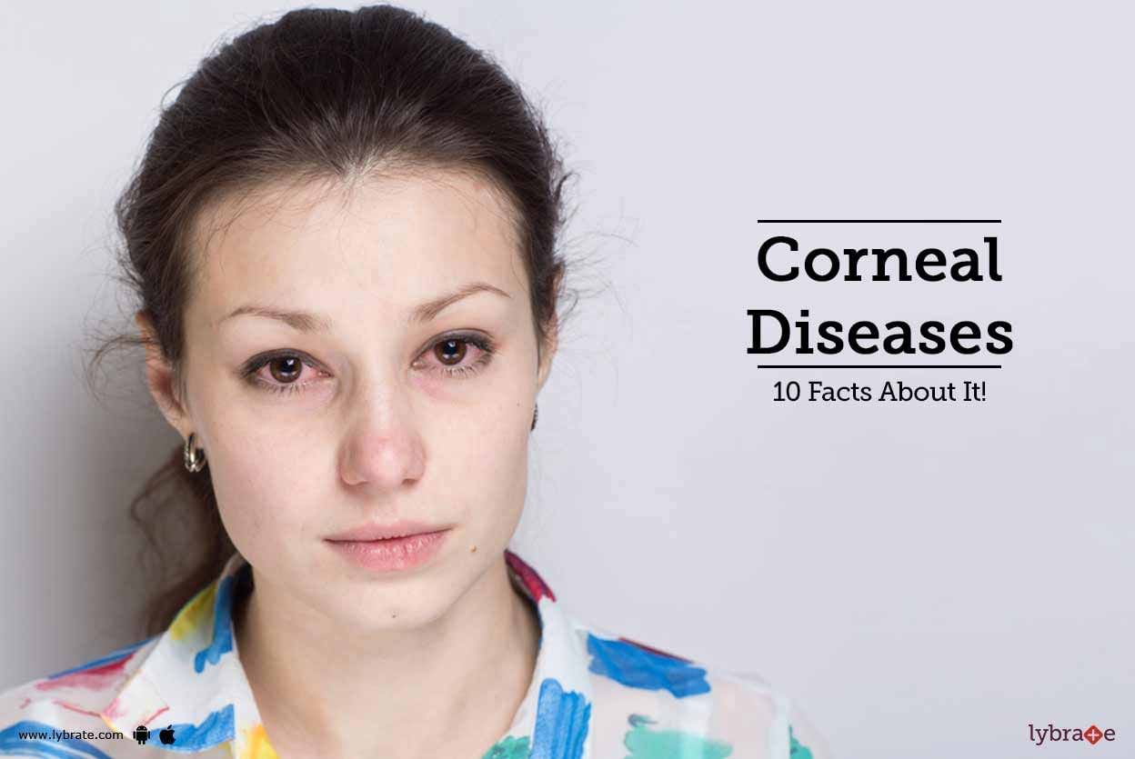Corneal Diseases - 10 Facts About It!