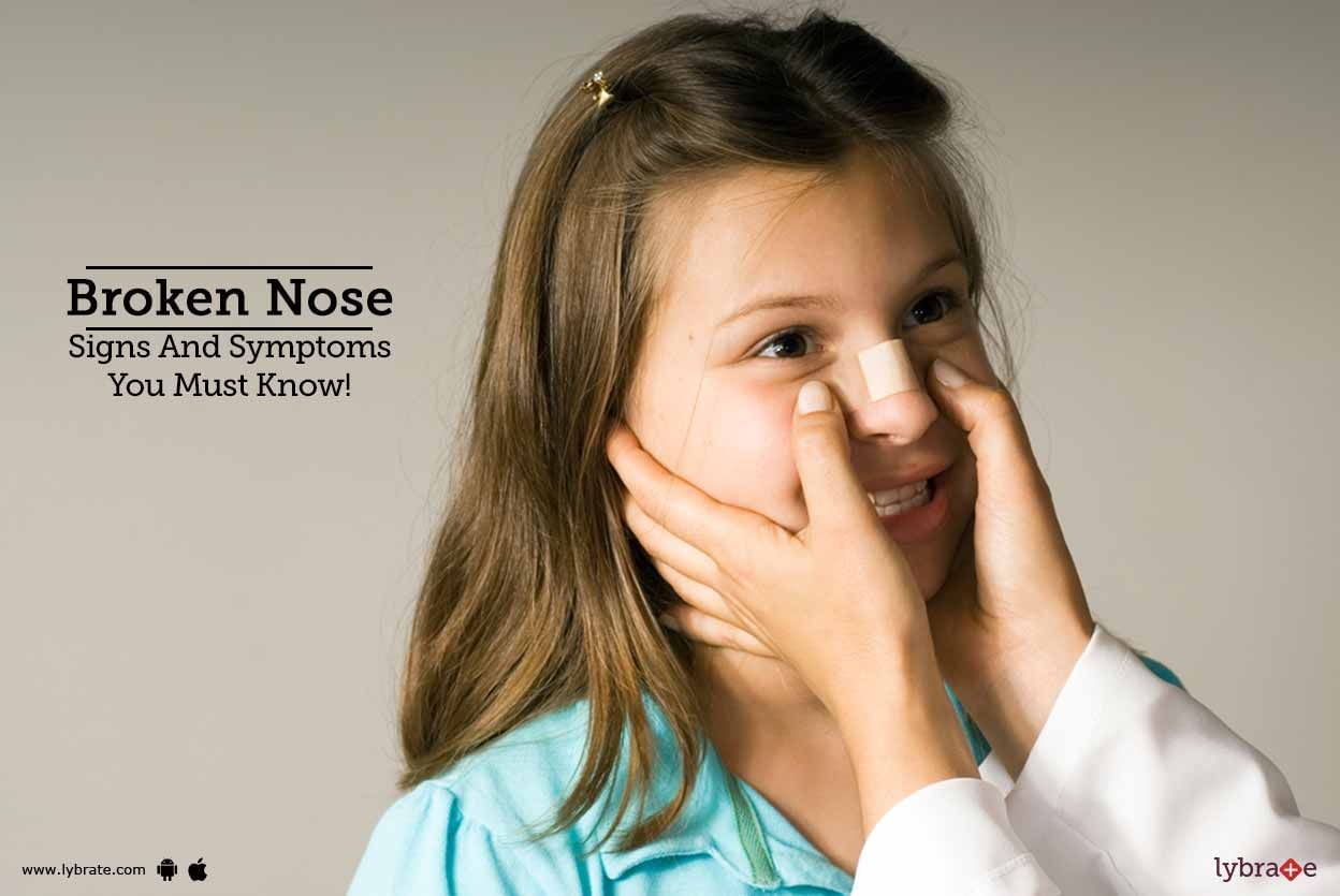 Broken Nose - Signs And Symptoms You Must Know!