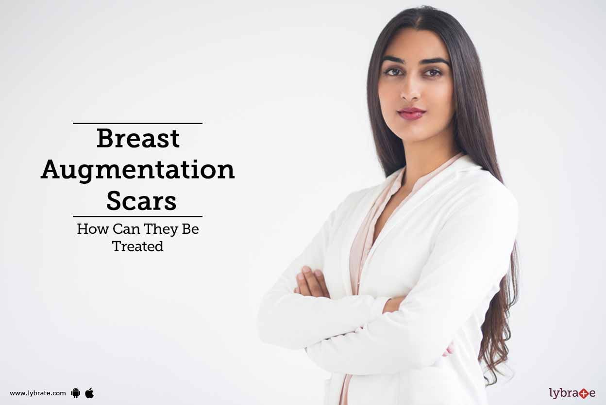 Breast Augmentation Scars: How Can They Be Treated?