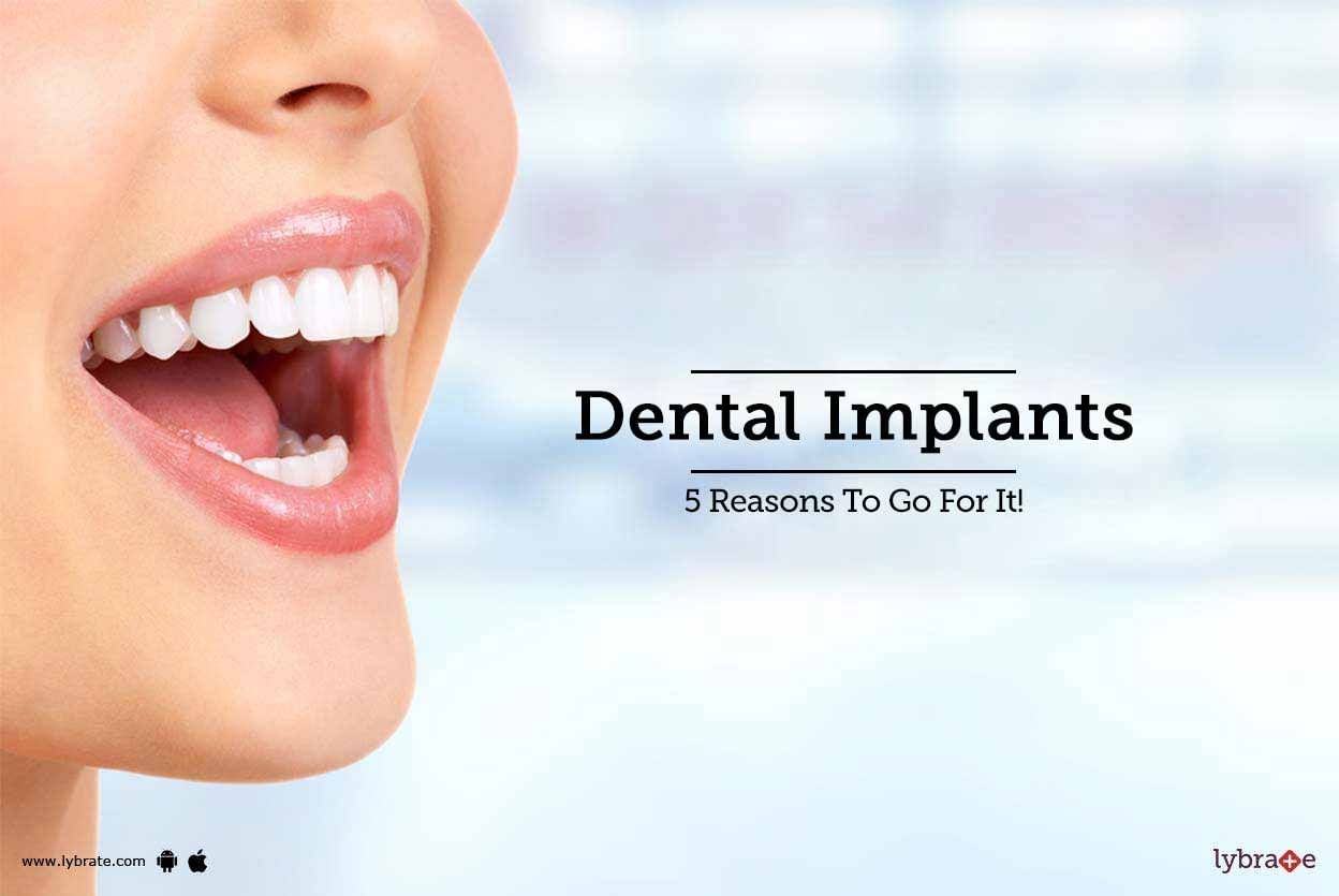 Dental Implants - 5 Reasons To Go For It!