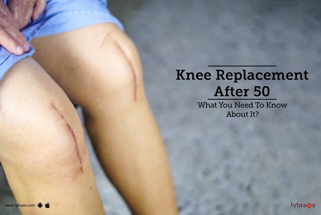 Knee Replacement After 50 - What You Need To Know About It?